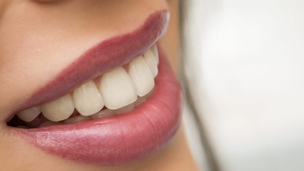 Dental Crown Plymouth