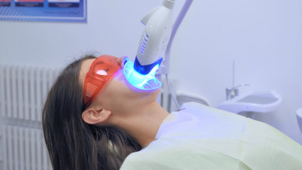 Zoom laser teeth whitening in action